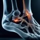 understanding the nature of bone spurs